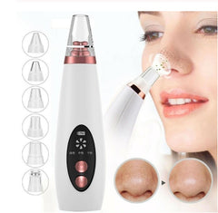 Advanced Microcrystalline Blackhead Remover – Professional Pore Cleansing Device